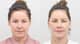 Slider image (6) AB Plastic Surgery